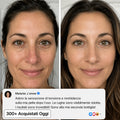 Avelys — Rimpolpa la pelle e cancella fino a 15 anni in soli 30 secondi.